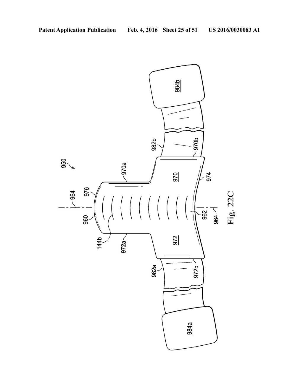 Externally Applied Intrapartum Support Device - diagram, schematic, and image 26