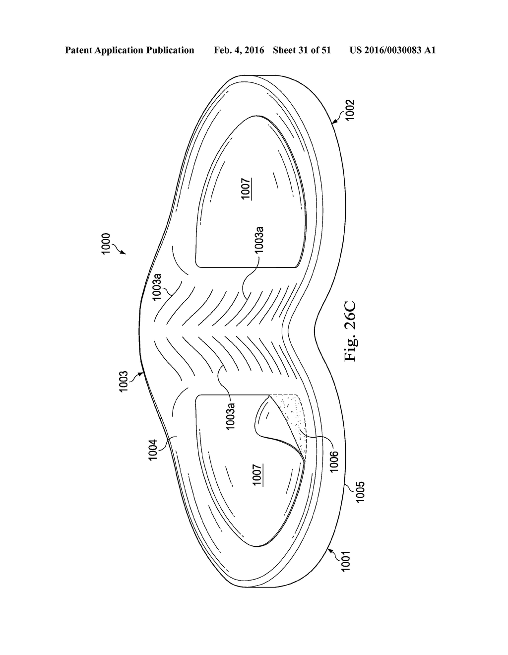 Externally Applied Intrapartum Support Device - diagram, schematic, and image 32