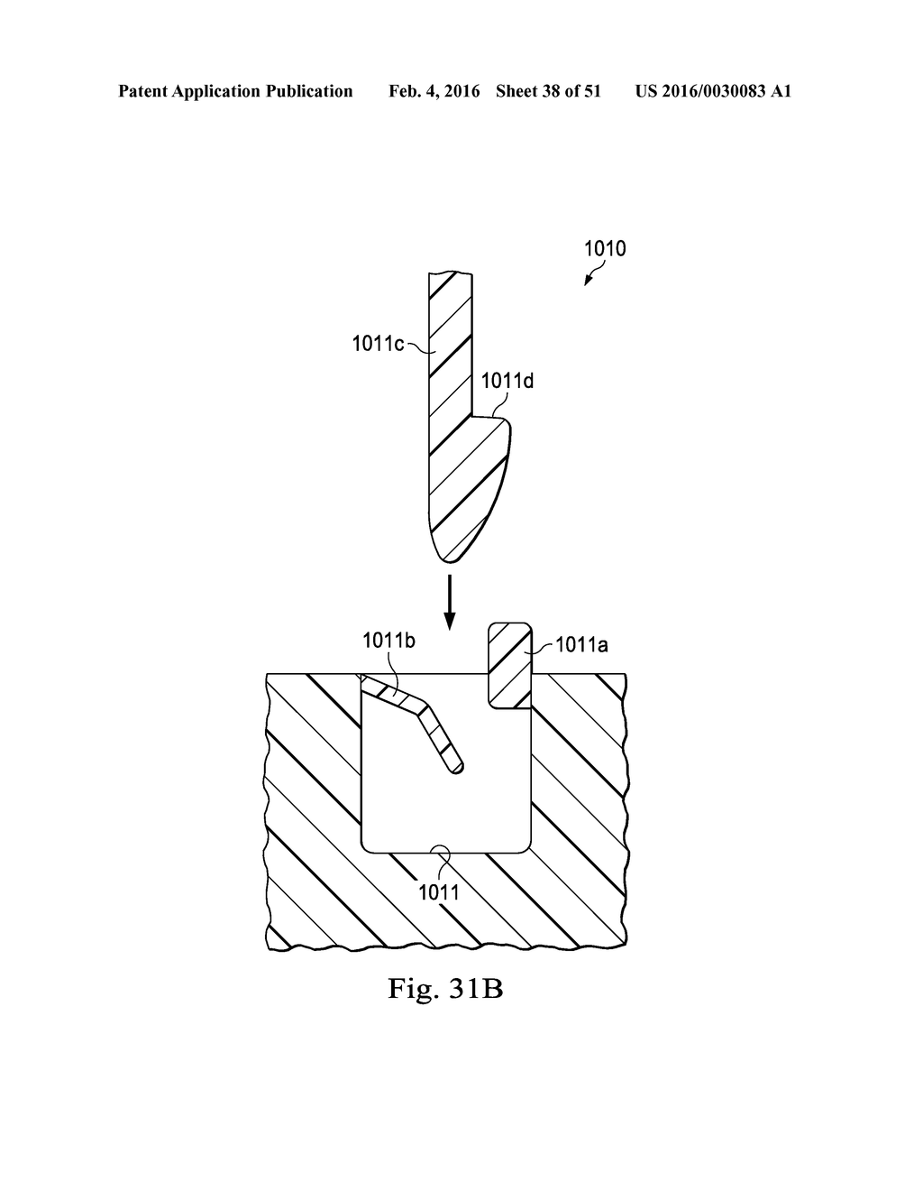 Externally Applied Intrapartum Support Device - diagram, schematic, and image 39