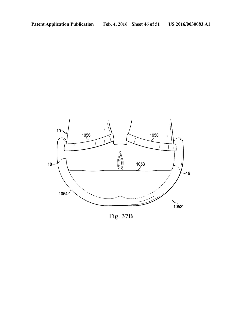 Externally Applied Intrapartum Support Device - diagram, schematic, and image 47