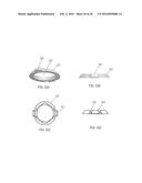 ORTHOPEDIC FIXATION DEVICES AND METHODS OF INSTALLATION THEREOF diagram and image