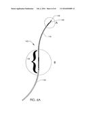 SKELETAL MANIPULATION METHOD diagram and image