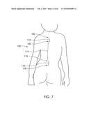 SKELETAL MANIPULATION METHOD diagram and image