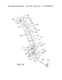 SKELETAL MANIPULATION METHOD diagram and image