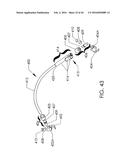 SKELETAL MANIPULATION METHOD diagram and image