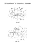 SKELETAL MANIPULATION METHOD diagram and image