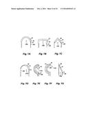 LAYERED FERROMAGNETIC COATED CONDUCTOR THERMAL SURGICAL TOOL diagram and image