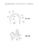 LAYERED FERROMAGNETIC COATED CONDUCTOR THERMAL SURGICAL TOOL diagram and image