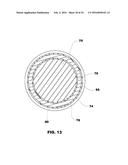 LAYERED FERROMAGNETIC COATED CONDUCTOR THERMAL SURGICAL TOOL diagram and image