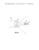 LAYERED FERROMAGNETIC COATED CONDUCTOR THERMAL SURGICAL TOOL diagram and image