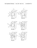 Static Self-Ligating Orthodontic Bracket and Method of Using Same diagram and image