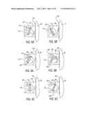 Static Self-Ligating Orthodontic Bracket and Method of Using Same diagram and image