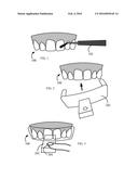 Safe Method For Bleaching Teeth diagram and image