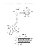 EXPANDABLE MEMBER FOR DEPLOYING A PROSTHETIC DEVICE diagram and image