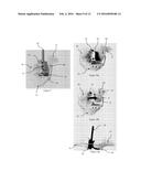 METHOD OF IMPLANTING A UNICONDYLAR KNEE PROSTHESIS diagram and image