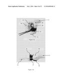 METHOD OF IMPLANTING A UNICONDYLAR KNEE PROSTHESIS diagram and image