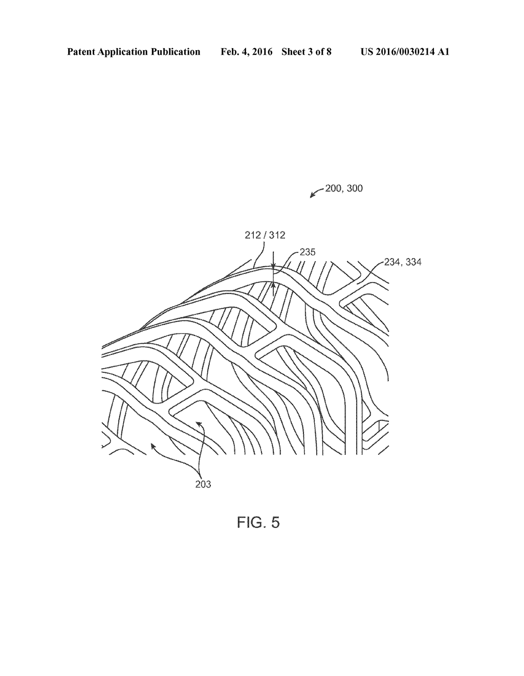 METHODS FOR UNIFORM CRIMPING AND DEPLOYMENT OF A POLYMER SCAFFOLD - diagram, schematic, and image 04