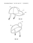 DEVICE FOR THE HINDRANCE OF SNORING AND OBSTRUCTIVE SLEEP APNEA diagram and image