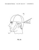 DEVICE FOR THE HINDRANCE OF SNORING AND OBSTRUCTIVE SLEEP APNEA diagram and image