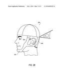 DEVICE FOR THE HINDRANCE OF SNORING AND OBSTRUCTIVE SLEEP APNEA diagram and image