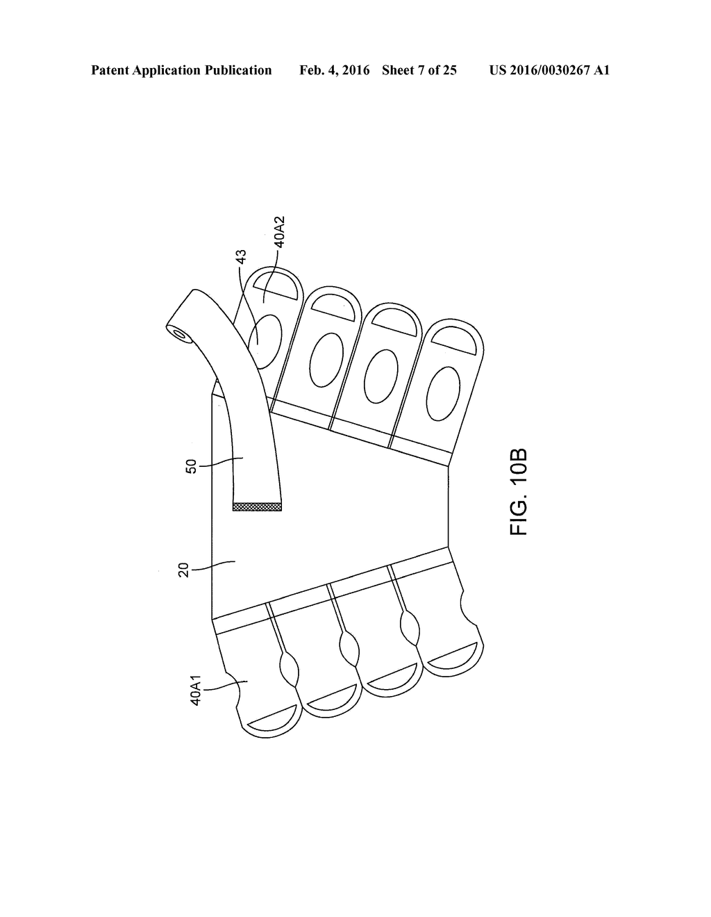 GRADUATED COMPRESSION DEVICE HAVING SEPARATE BODY AND BANDS - diagram, schematic, and image 08