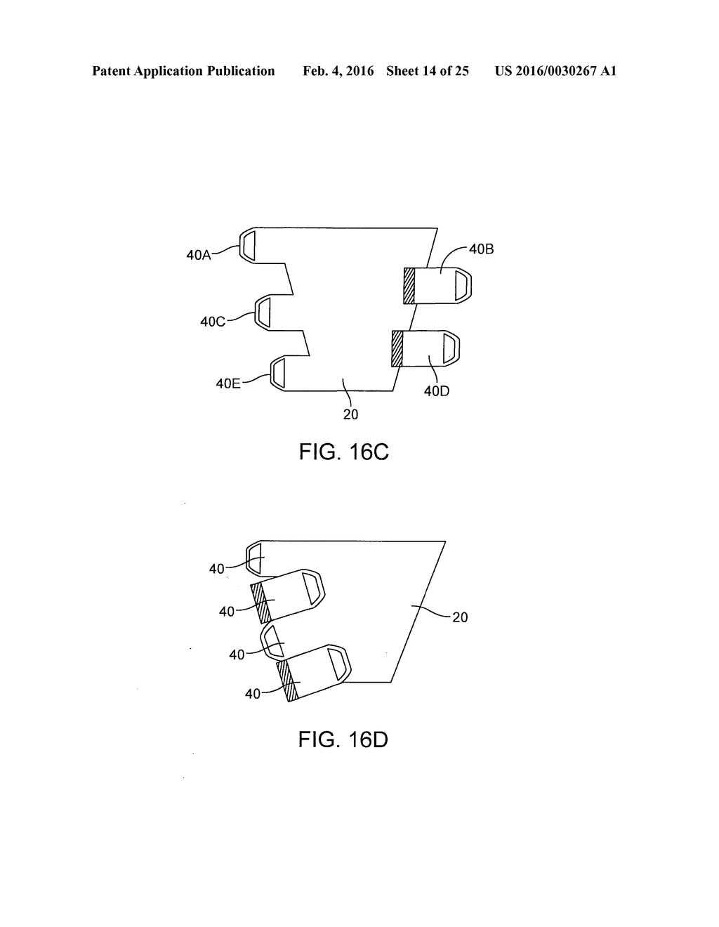 GRADUATED COMPRESSION DEVICE HAVING SEPARATE BODY AND BANDS - diagram, schematic, and image 15