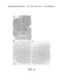 Method for Decellularization of Tissue Grafts diagram and image