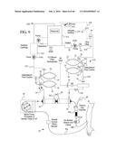 DIALYSIS SYSTEM WITH BALANCE CHAMBER PRIME AND RINSEBACK diagram and image