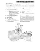 AIRWAY EXCHANGE CATHETER diagram and image