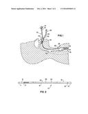 AIRWAY EXCHANGE CATHETER diagram and image