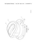 VASCULAR ACCESS PORT diagram and image