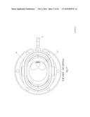 VASCULAR ACCESS PORT diagram and image