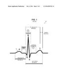 SYSTEM AND METHOD FOR STIMULATING THE HEART VIA STORAGE OF MULTI-WAVEFORMS     IN A CARDIAC STIMULATION DEVICE diagram and image