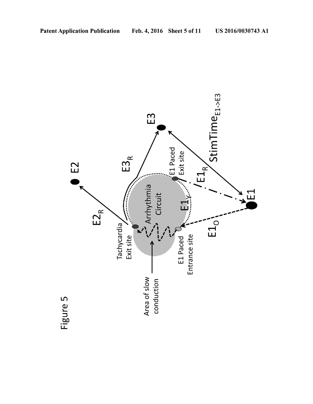 SYSTEMS AND METHODS TO OPTIMIZE ANTI-TACHYCARDIAL PACING (ATP) - diagram, schematic, and image 06