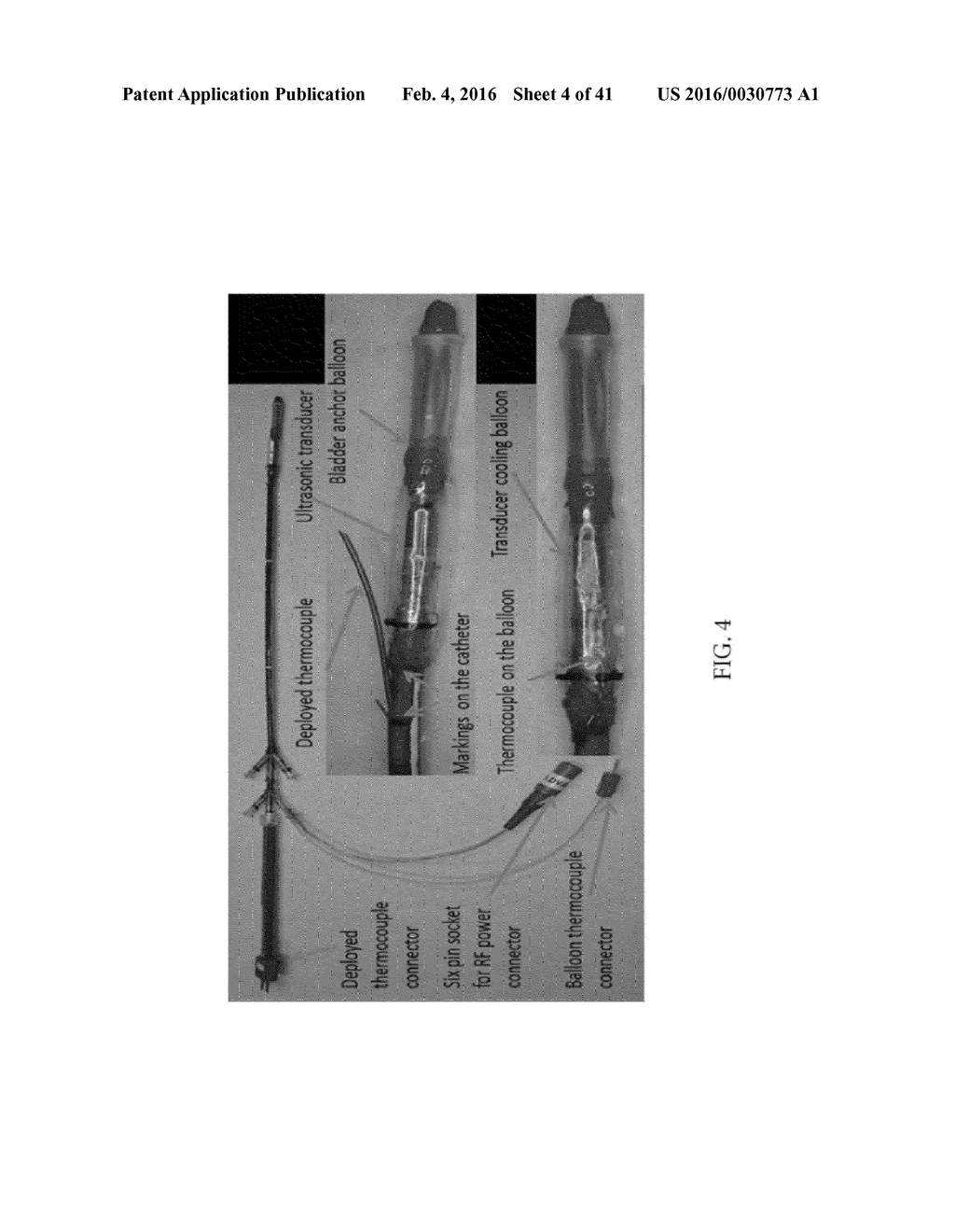 Ultrasound Therapy Catheter with Multi-Chambered Balloons for Transluminal     Longitudinal Positioning - diagram, schematic, and image 05