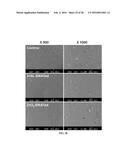 Application of the newly developed technology in stainless steel for     biomedical implant diagram and image