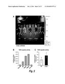 METHODS FOR TREATING OSTEOGENESIS IMPERFECTA diagram and image