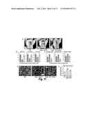 METHODS FOR TREATING OSTEOGENESIS IMPERFECTA diagram and image