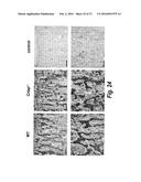 METHODS FOR TREATING OSTEOGENESIS IMPERFECTA diagram and image