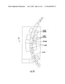 VEHICLE WHEEL BALANCE WEIGHTS diagram and image