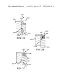 WEARABLE CAMERA SYSTEMS AND APPARATUS AND METHOD FOR ATTACHING CAMERA     SYSTEMS OR OTHER ELECTRONIC DEVICES TO WEARABLE ARTICLES diagram and image