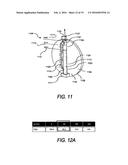 TEMPERATURE DRIVEN WINDING SYSTEM diagram and image