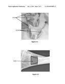 A Method of Determining an Indicator for the Stability of a Bone Implant diagram and image