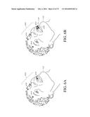 SYSTEMS, DEVICES, AND METHODS FOR TRACKING AND COMPENSATING FOR PATIENT     MOTION DURING A MEDICAL IMAGING SCAN diagram and image