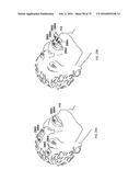 SYSTEMS, DEVICES, AND METHODS FOR TRACKING AND COMPENSATING FOR PATIENT     MOTION DURING A MEDICAL IMAGING SCAN diagram and image