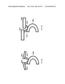 SYSTEMS, DEVICES, AND METHODS FOR TRACKING AND COMPENSATING FOR PATIENT     MOTION DURING A MEDICAL IMAGING SCAN diagram and image