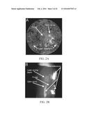 SELF-ILLUMINATED HANDHELD LENS FOR RETINAL EXAMINATION AND PHOTOGRAPHY AND     RELATED METHOD THEREOF diagram and image