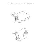 SEGMENTED ATTACHMENT DEVICE diagram and image