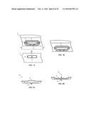 SEGMENTED ATTACHMENT DEVICE diagram and image