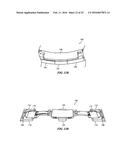 SEGMENTED ATTACHMENT DEVICE diagram and image